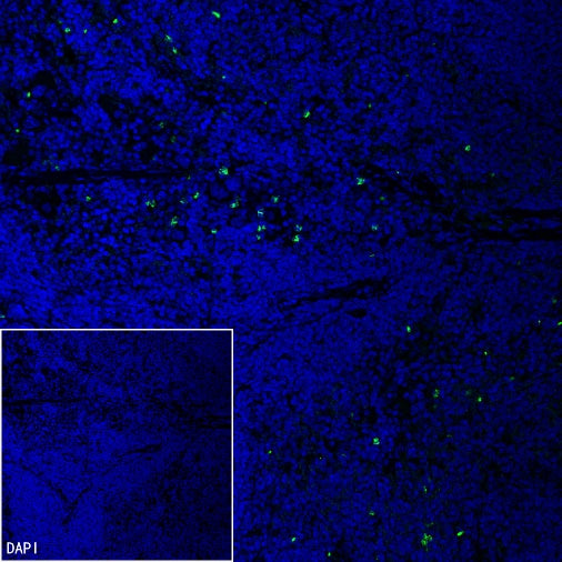 Olfm4 Recombinant Rabbit mAb (S-2748-67)