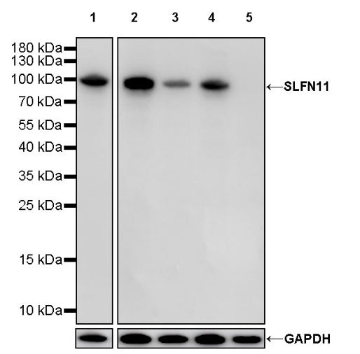 SLFN11 Recombinant Mouse mAb (S-1565-283)