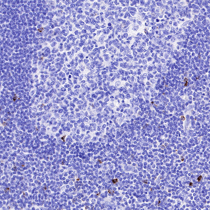 LAG3 Recombinant Rabbit mAb (SDT-R159)