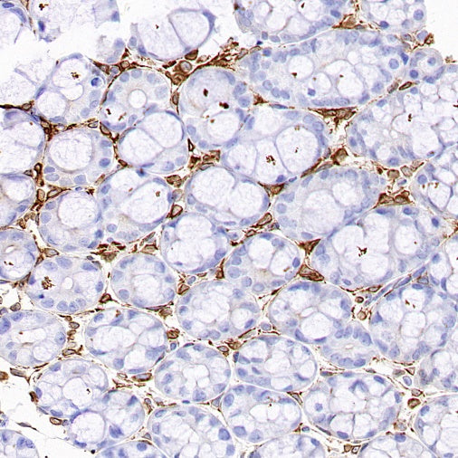 COX1/Cyclooxygenase 1 Recombinant Rabbit mAb (S-1478-48)