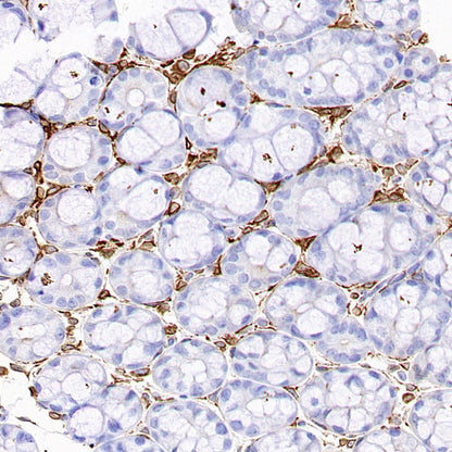 COX1/Cyclooxygenase 1 Recombinant Rabbit mAb (S-1478-48)