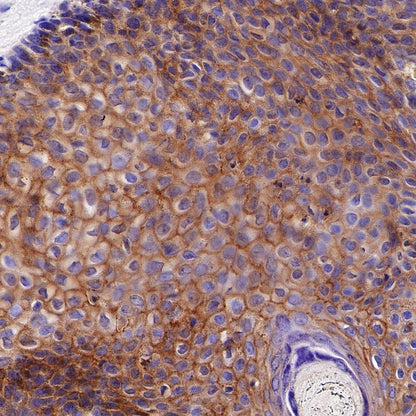 Nectin-1/PVRL1 Recombinant Rabbit mAb (S-279-140)