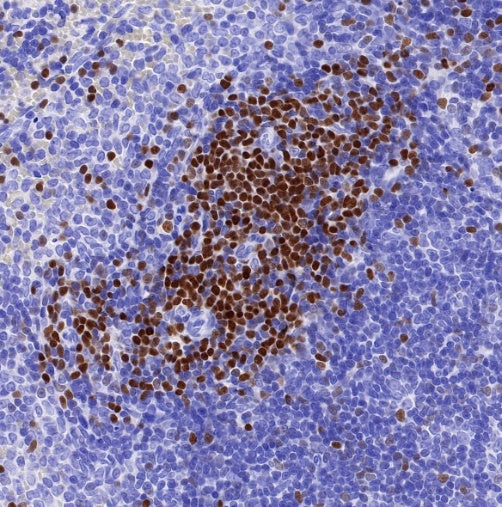 LEF1 Recombinant Rabbit mAb (S-500-34)