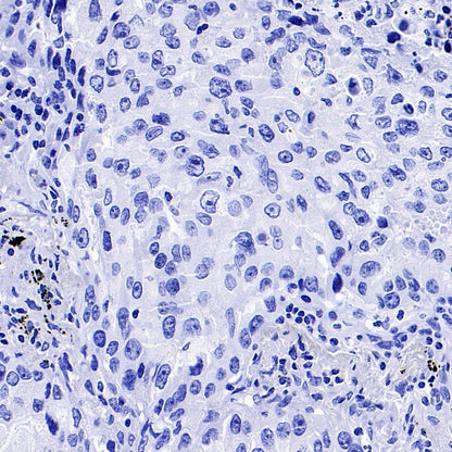 EGFR (L858R) Recombinant Rabbit mAb (SDT-421-202)