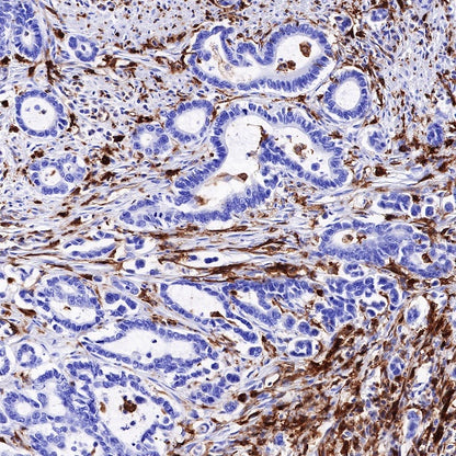 HLA-DP alpha1 Recombinant Rabbit mAb (S-R243)