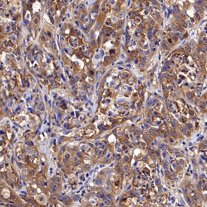Hexokinase II Rabbit Polyclonal Antibody