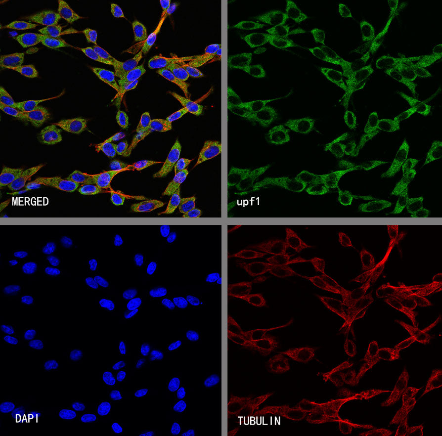 Upf1 Rabbit Polyclonal Antibody
