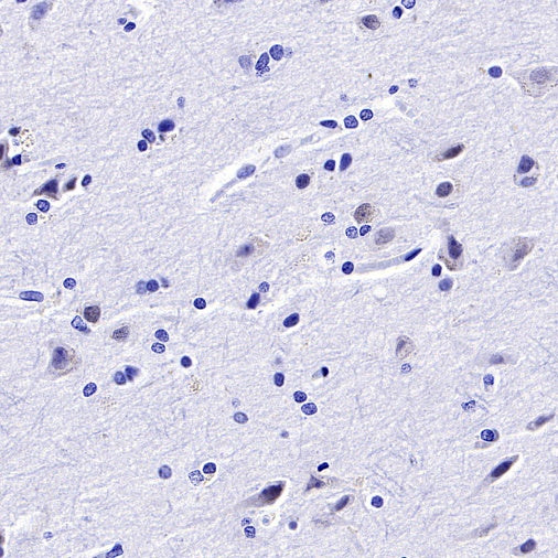TBR1 Recombinant Rabbit mAb (S-1102-34)