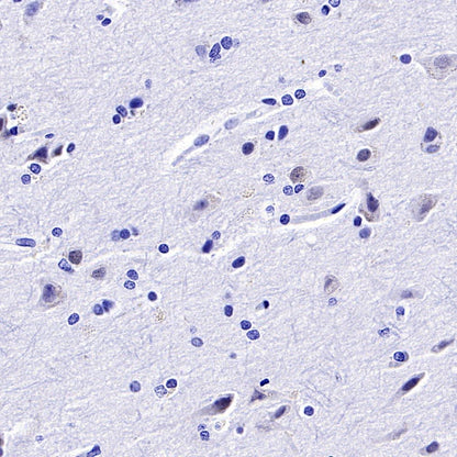 TBR1 Recombinant Rabbit mAb (S-1102-34)