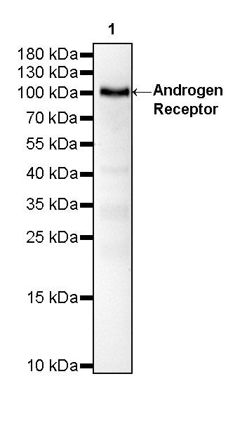 Androgen Receptor Recombinant Rabbit mAb (SDT-R157)