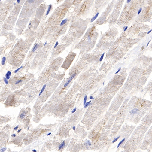 TWEAKR/FN14 Recombinant Rabbit mAb (S-913-1)