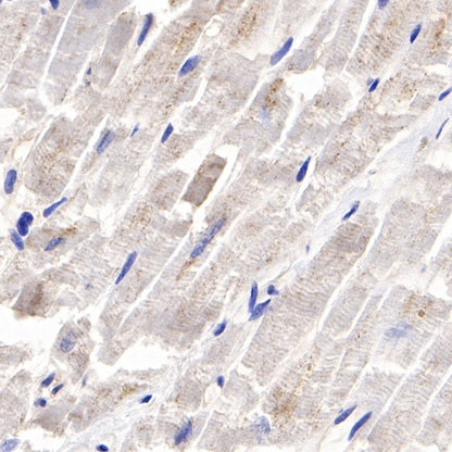 TWEAKR/FN14 Recombinant Rabbit mAb (S-913-1)