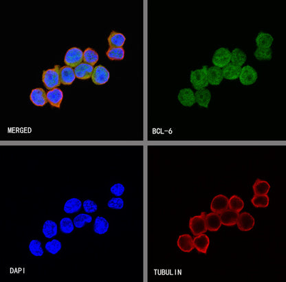 S-RMab® BCL-6 Recombinant Rabbit mAb,PBS Only (SDT-103-21)