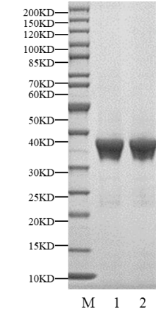 IRAK4 His Tag Protein, Human
