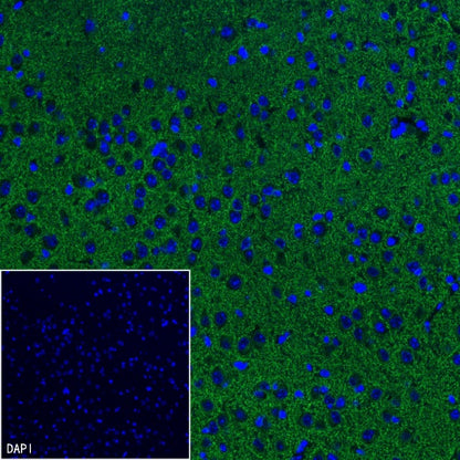 KCC2 Recombinant Rabbit mAb (S-3044-2)