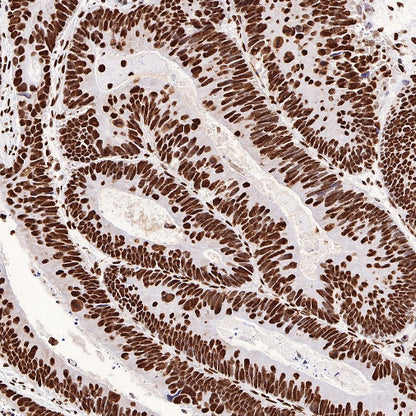 ILF3 Recombinant Rabbit mAb (S-R342)