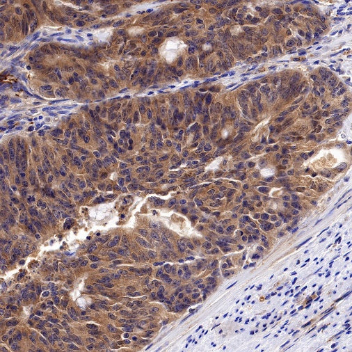 Peroxiredoxin 3 Rabbit Polyclonal Antibody