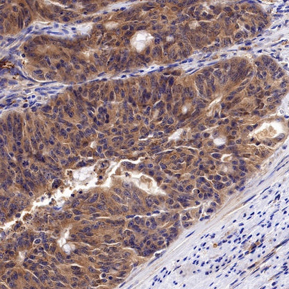 Peroxiredoxin 3 Rabbit Polyclonal Antibody
