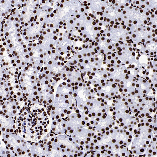 FUS Recombinant Rabbit mAb (S-1015-21)