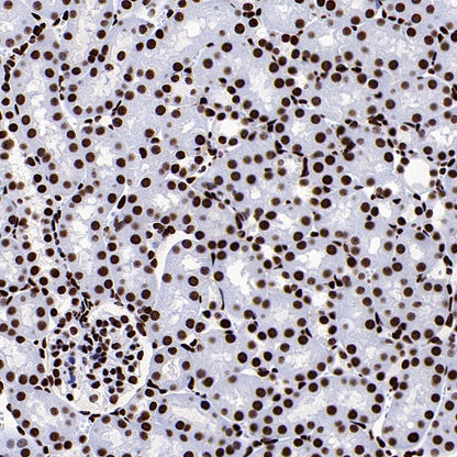 FUS Recombinant Rabbit mAb (S-1015-21)