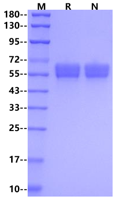 Serpin A1/Alpha-1-antitrypsin His Tag Protein, Human