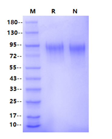 CD6 His Tag Protein, Human