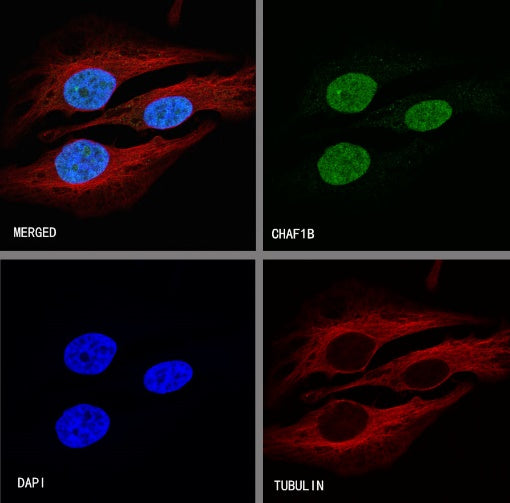 CHAF1b Recombinant Rabbit mAb (S-R316)
