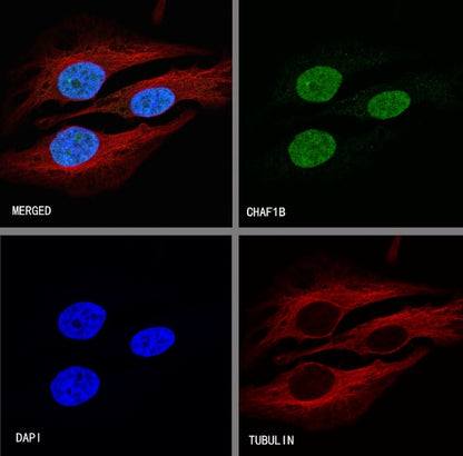 CHAF1b Recombinant Rabbit mAb (S-R316)