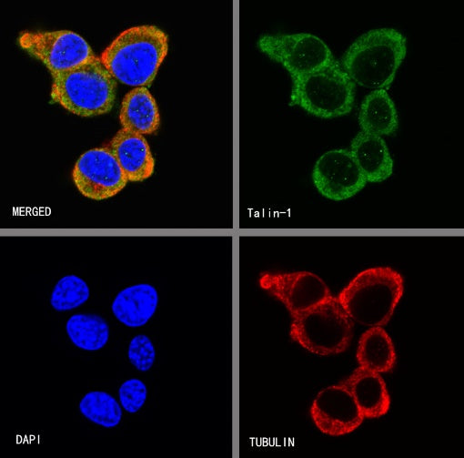 Talin-1 Recombinant Rabbit mAb (S-1483-25)