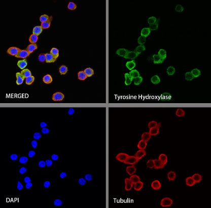 Tyrosine Hydroxylase Recombinant Rabbit mAb (S-1001-26)