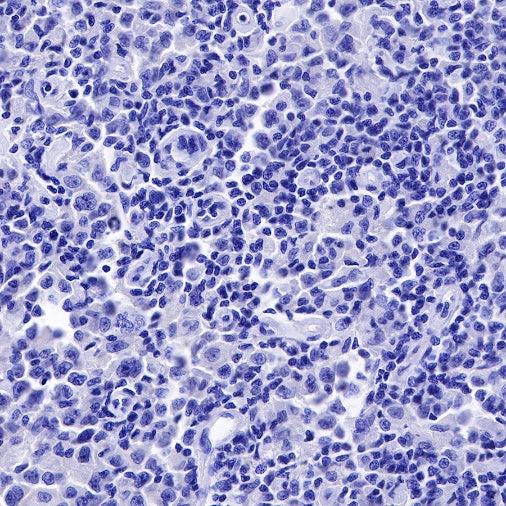 PAX5 Recombinant Rat mAb (S-R200)