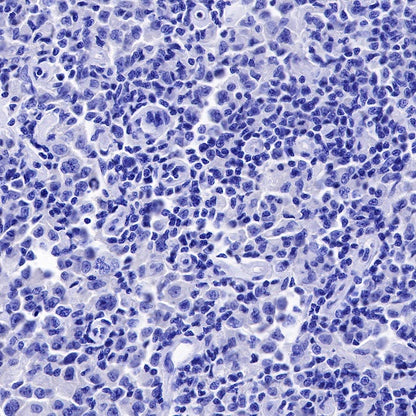 PAX5 Recombinant Rat mAb (S-R200)