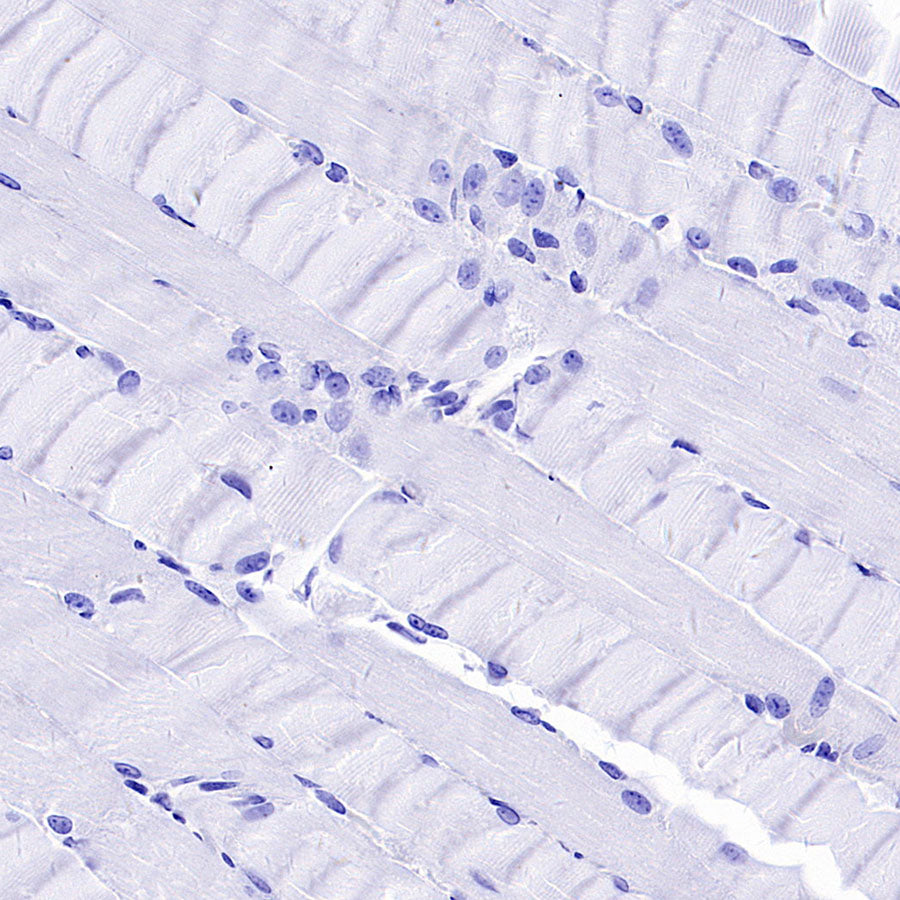 PTK7 Recombinant Rabbit mAb ,PBS Only(SDT-2432-156)