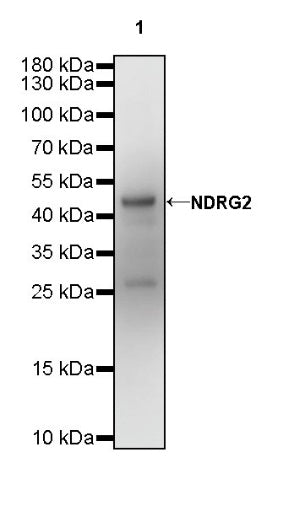 NDRG2 Recombinant Rabbit mAb (S-618-76)