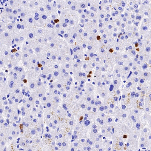 CXCR2 Recombinant Rabbit mAb (S-1292-30)