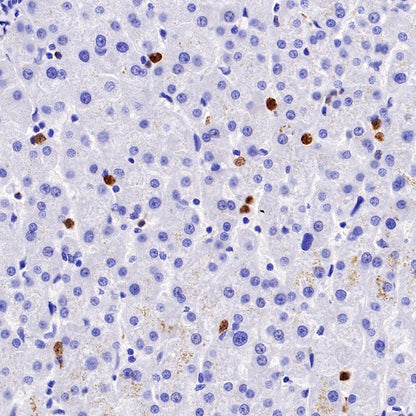 CXCR2 Recombinant Rabbit mAb (S-1292-30)