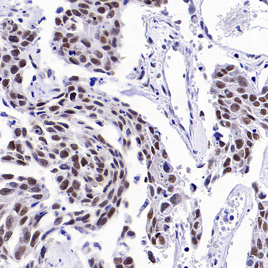 BRCA2 Recombinant Rabbit mAb (S-5306)