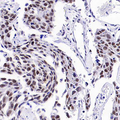 BRCA2 Recombinant Rabbit mAb (S-5306)