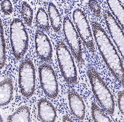 TDP-43 Recombinant Rabbit mAb (S-989-41)