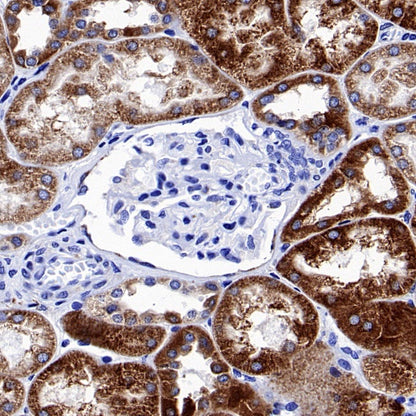 ACSL1 Recombinant Rabbit mAb (S-811-150)