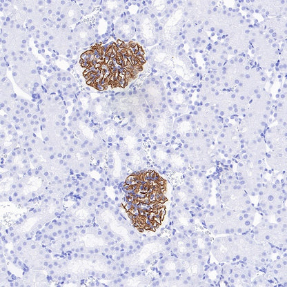 VEGF Receptor 2/FLK-1 Recombinant Rabbit mAb (SDT-1519-144)