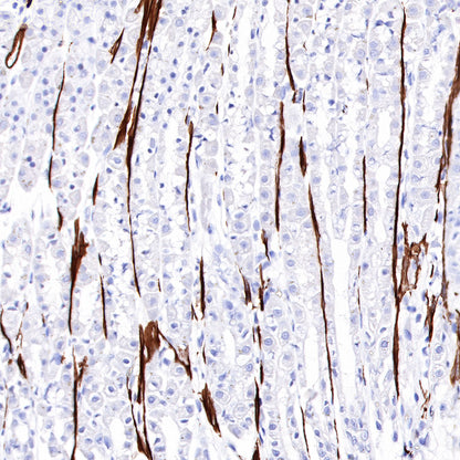 S-RMab® alpha smooth muscle Actin (SMA) Recombinant Rabbit mAb,PBS Only (SDT-301-142)