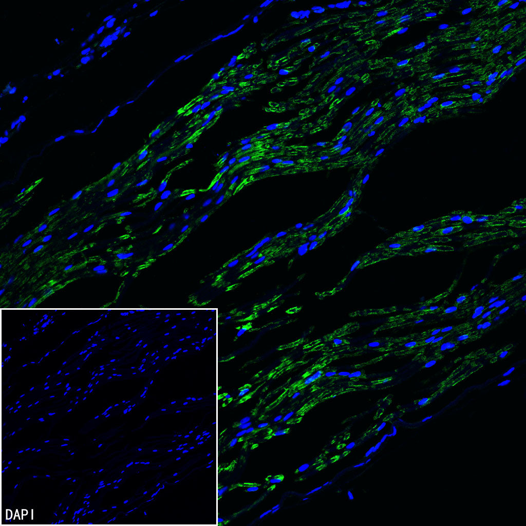 PMP22 Recombinant Rabbit mAb (S-5305)