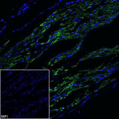 PMP22 Recombinant Rabbit mAb (S-5305)