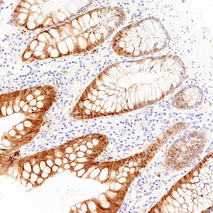 AK1C3 Rabbit Polyclonal Antibody