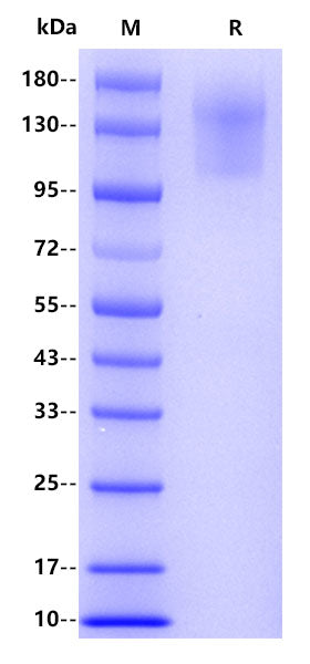 Human CD45 Protein, His Tag