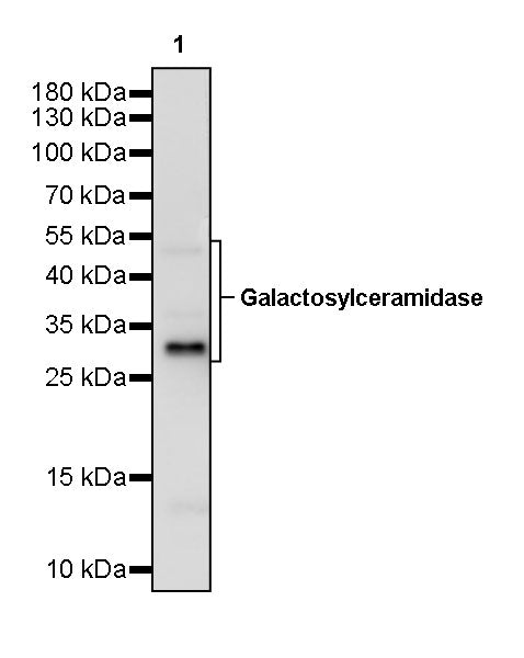 Galactosylceramidase Recombinant Rabbit mAb (S-3402-17)