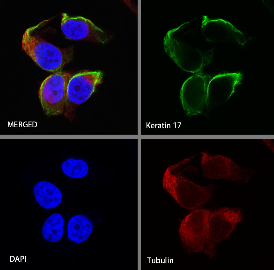 Keratin 17 Recombinant Rabbit mAb (SDT-011-43)