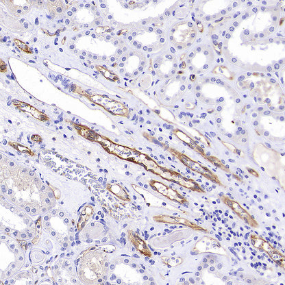 ICAM2/CD102 Rabbit Polyclonal Antibody