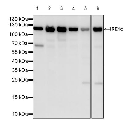 IRE1 Recombinant Rabbit mAb (S-1356-124)
